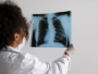 Tosse por mais de 3 semanas? Salvador alerta para tuberculose e reforça importância de diagnóstico precoce